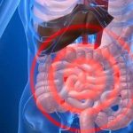 Pengobatan Perdarahan Gastrointestinal: Cara Mengatasi Masalah Lambung dengan Efektif