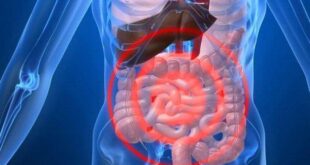 Pengobatan Perdarahan Gastrointestinal: Cara Mengatasi Masalah Lambung dengan Efektif